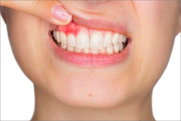 gum pain causes
