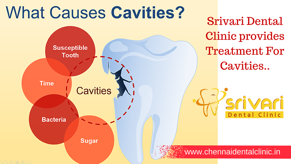cavity teeth causes